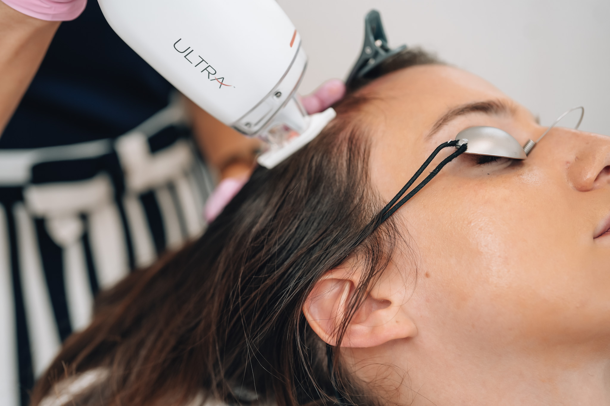 Lutronic Ultra laser used on a gentle setting at Skin With Bea Esthetics in Scottsdale