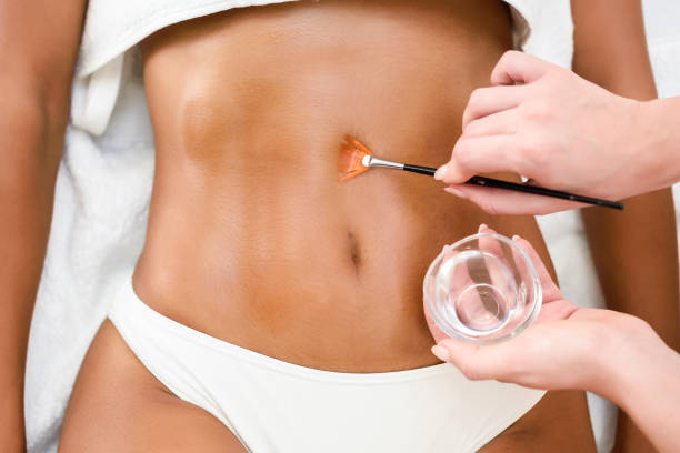 keralase treatment Phoenix