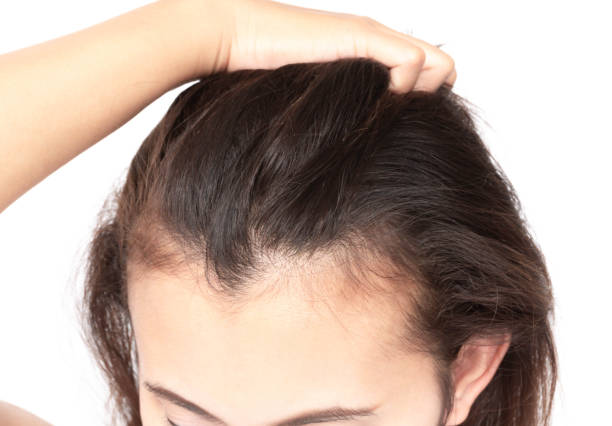 thinning hair treatment Phoenix