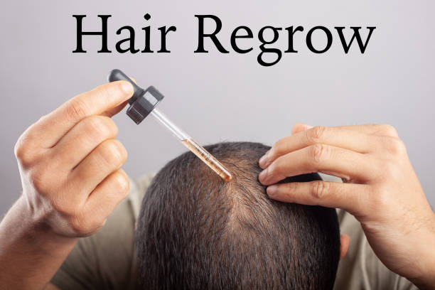 hair regrowth treatment Phoenix