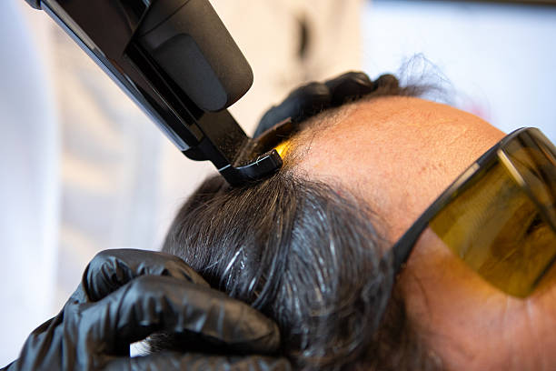 laser hair regrowth Phoenix